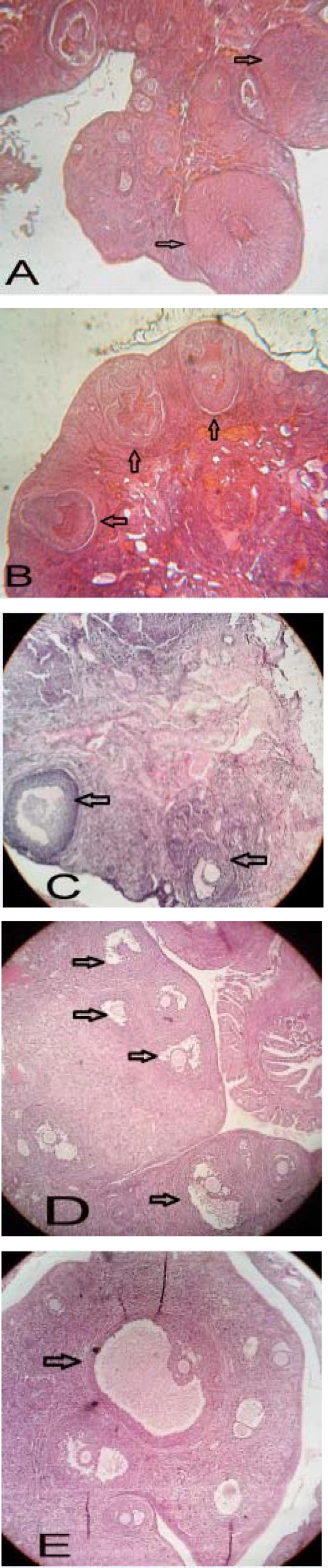 Histological analysis of normal (A), PCOS (B) and 50, 100 and 200 mg/Kg BW green tea extract -treated PCOS (C, D and E respectively) ovaries. Arrows indicate the corpus luteum in figure A, some cysts in figure B, some antral follicles in figure C, some late pre antral follicles in figure D and <i><u>Gratian</u></i> follicles in figure E. Ovarian sections were stained with hematoxylin and eosin, X400.