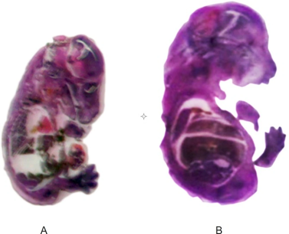 Photomicrograph of H and E- stained normal (A), metronidazole (B) mice fetus sections<b>. </b>The liver and brain were probed