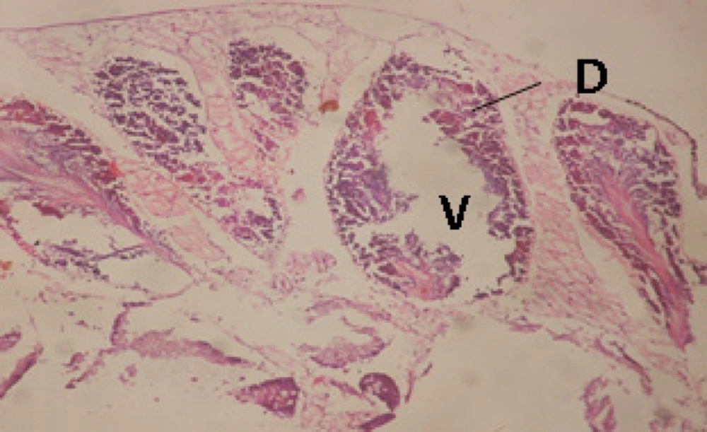 T.S. in treated B. <i>alexandrina</i> with 40 ppm fruits extract (Hermaphrodite region). D: degeneration V: vacuoles X= 200