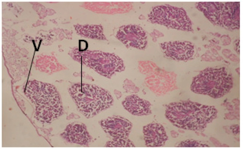 T.S. in treated B. <i>alexandrina</i> with 20 ppm fruits extract (Hermaphrodite region). D: degeneration V: vacuoles X= 200