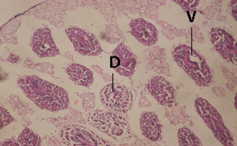 T.S. in treated B. <i>alexandrina</i> with 10 ppm fruits extract (Hermaphrodite region). D: degeneration V: vacuoles X= 200