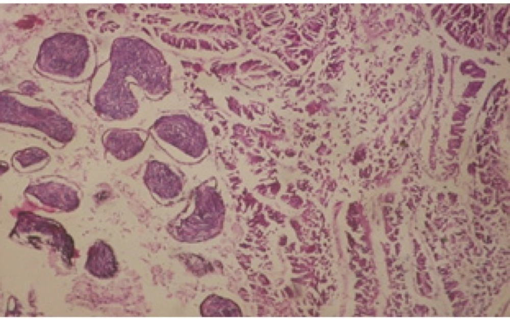 T.S. in treated B. <i>alexandrina</i> with 5 ppm fruits extract (Hermaphrodite region). X=200.