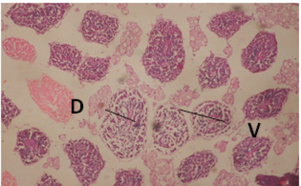 T.S. in treated B. <i>alexandrina</i> with 40 ppm bark extract (Hermaphrodite region). D: degeneration V: vacuoles X= 200.
