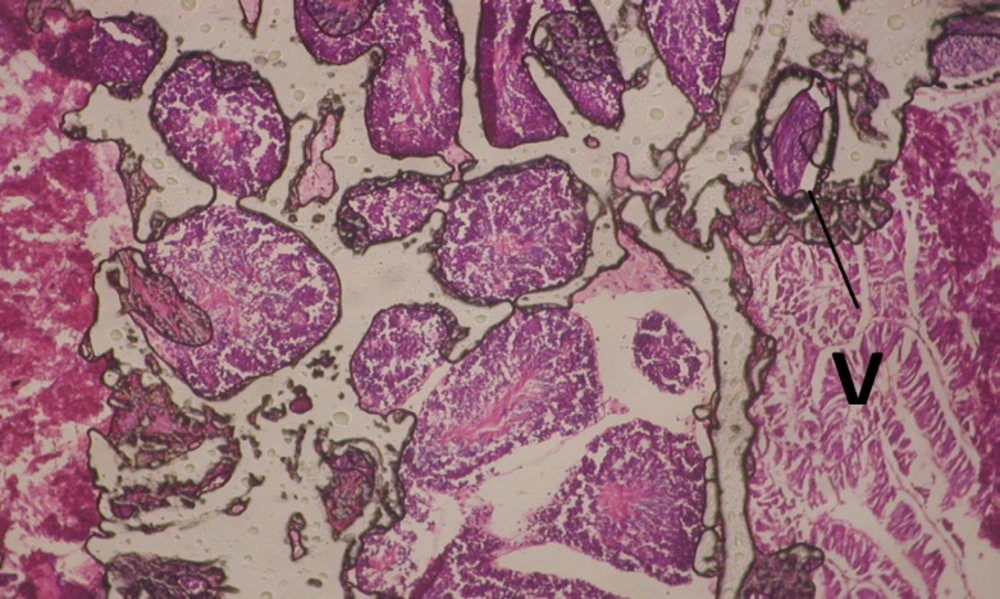 T.S. in treated B. <i>alexandrina</i> with 20 ppm bark extract (Hermaphrodite region). V: vacules X= 200.