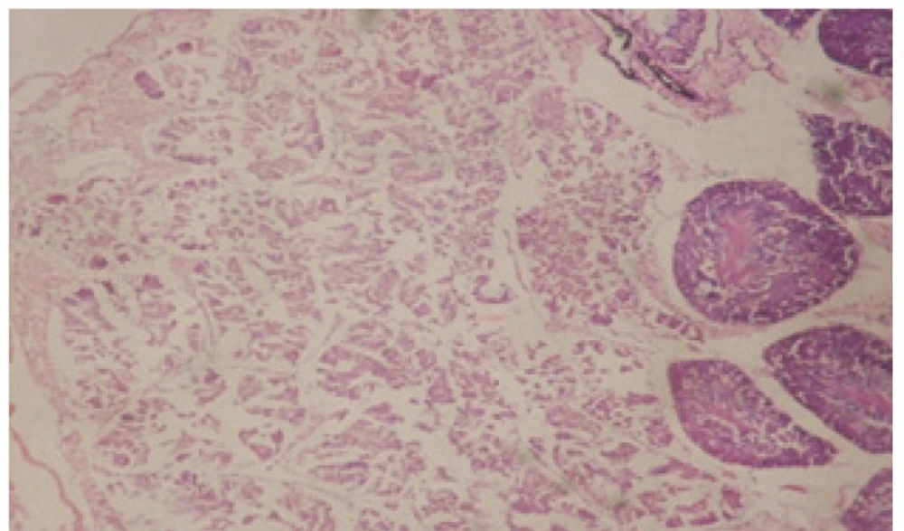 T.S. in treated B. <i>alexandrina</i> with 10 ppm bark extract (Hermaphrodite region). X= 200.