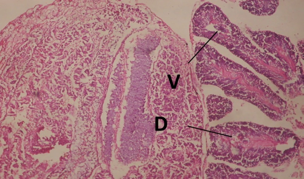 T.S. in treated B. <i>alexandrina</i> with 40 ppm leaves extract (Hermaphrodite region). D: degeneration V: vacuoles X= 200.