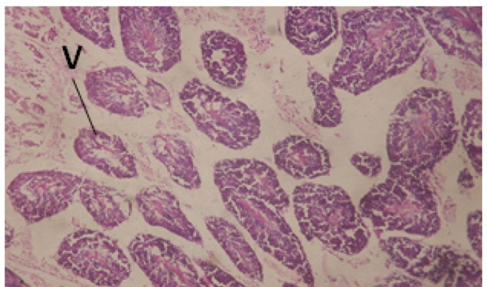 T.S. in treated B. <i>alexandrina</i> with 20 ppm leaf extract (Hermaphrodite region). V: vacuoles X= 200.