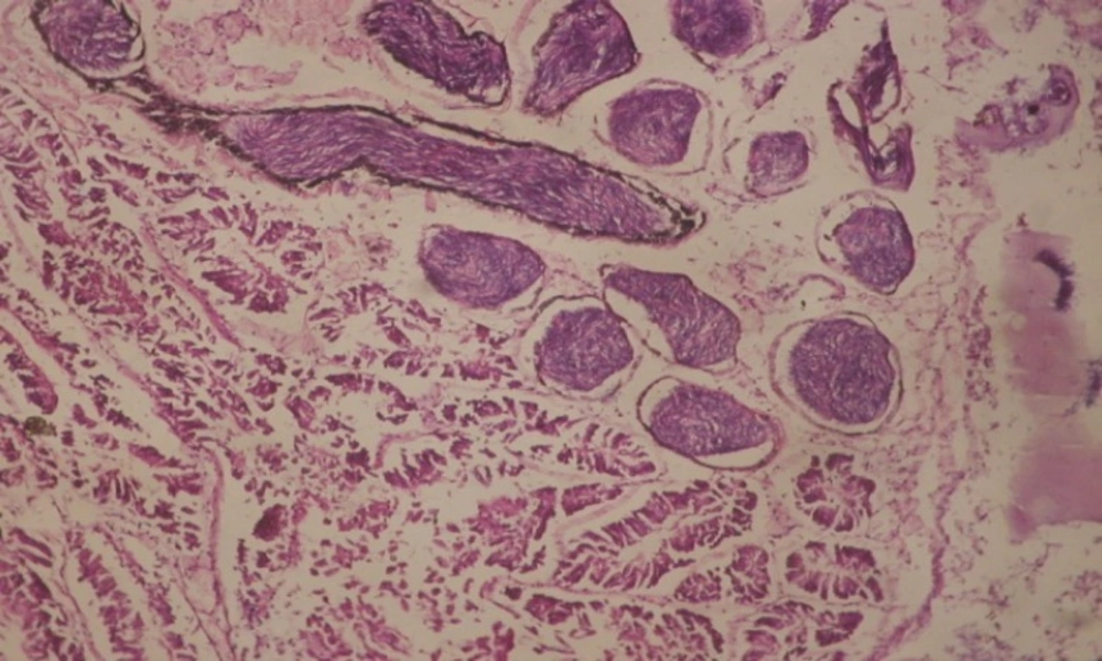 T.S. in treated B. <i>alexandrina</i> with 10 ppm leaf extract (Hermaphrodite region). X= 200.