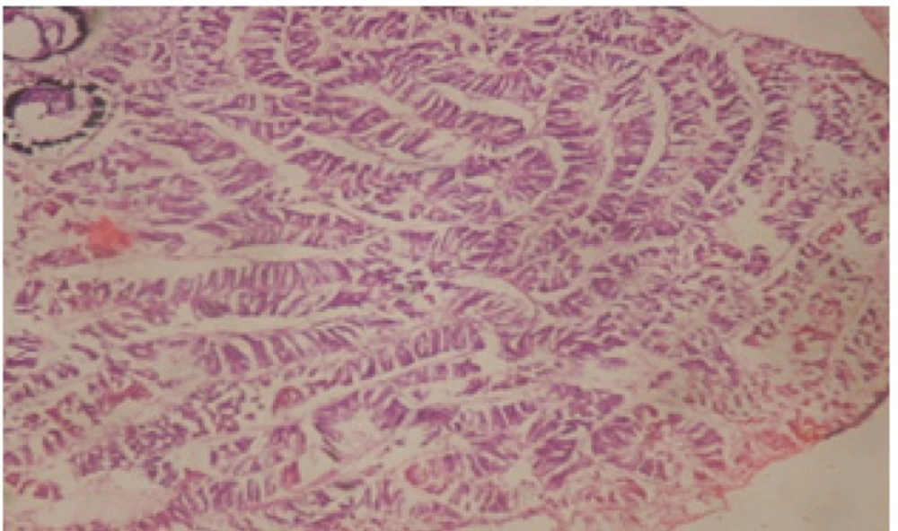 T.S. in control B. <i>alexandrina</i> (digestive acini) showing normal columnar epithelial cells. X= 200.