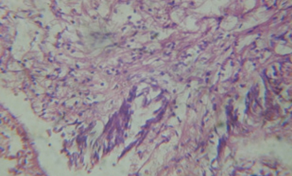 T.S. in treated B. <i>alexandrina</i> with 20 ppm fruits extract (digestive acini). X= 200