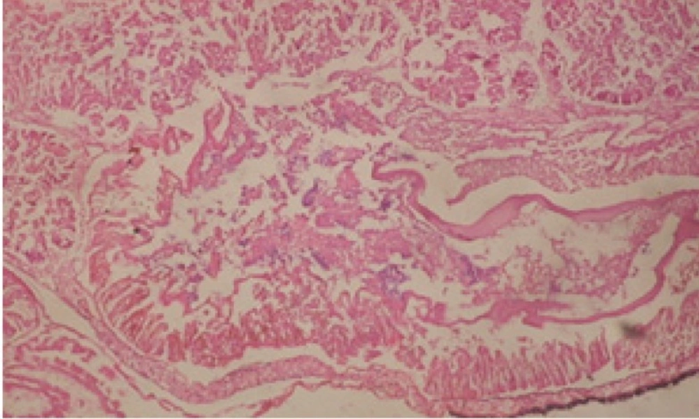 T.S. in treated B. <i>alexandrina</i> with 20 ppm bark extract (digestive acini). X= 200.