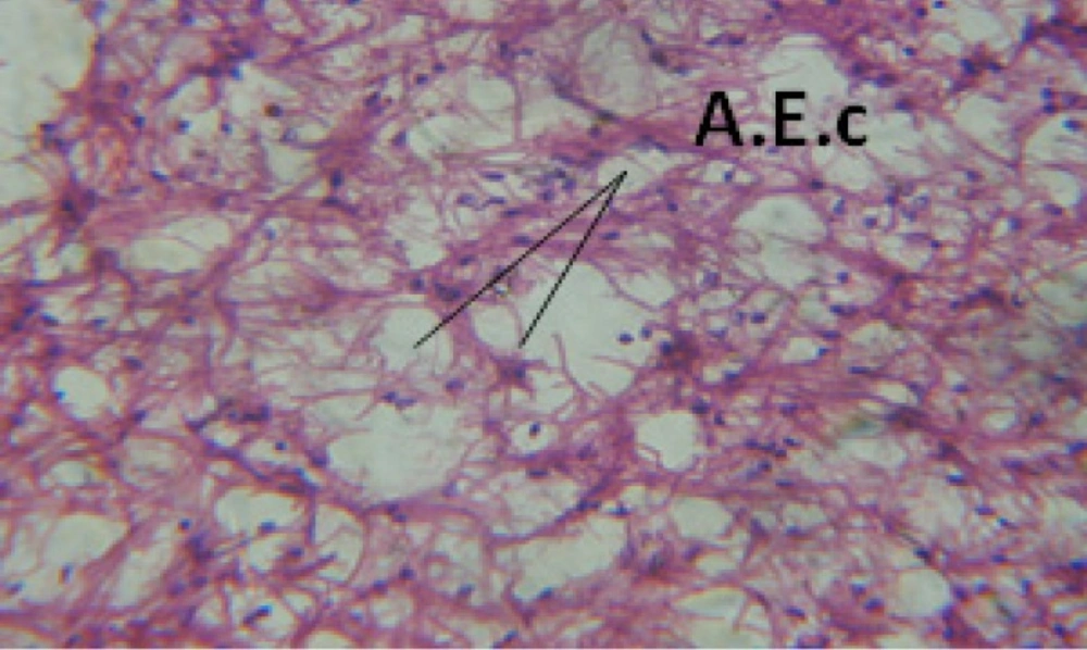 T.S. in treated B. <i>alexandrina</i> with 20 ppm fruits extract showing digestive epithelia. A.E.c: evacuated epithelial cells X = 200