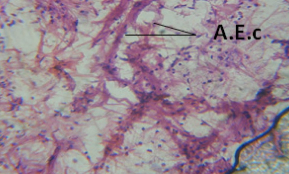 T.S. in treated B. <i>alexandrina</i> with 10 ppm fruits extract showing digestive epithelia. A.E.c: evacuated epithelial cells X = 200