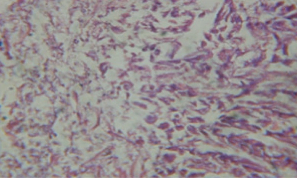 T.S. in treated B. <i>alexandrina</i> with 5 ppm fruits extract showing digestive epithelia. A.E.c: evacuated epithelial cells X = 200