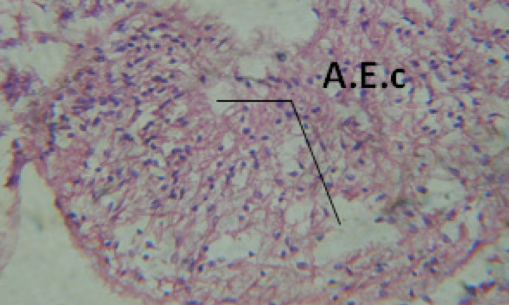 T.S. in treated B. <i>alexandrina</i> with 40 ppm bark extract showing digestive epithelia. A.E.c: evacuated epithelial cells X = 200
