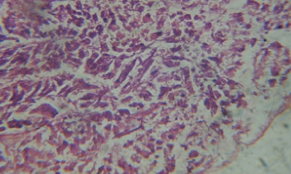 T.S. in treated B. <i>alexandrina</i> with 10 ppm bark extract showing digestive epithelia. X = 200