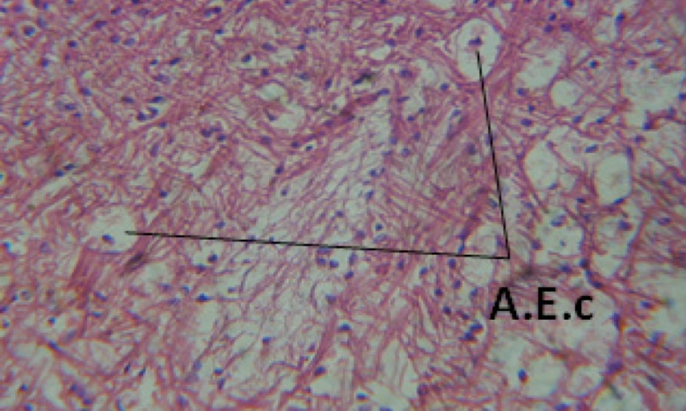 T.S. in treated B. <i>alexandrina</i> with 40 ppm leaves extract showing digestive epithelia. A.E.c: evacuated epithelial cells X = 200