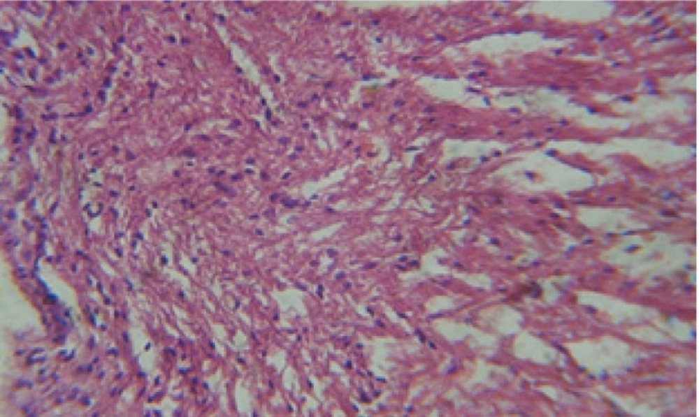 T.S. in treated B. <i>alexandrina</i> with 20 ppm leaves extract showing digestive epithelia. X = 200