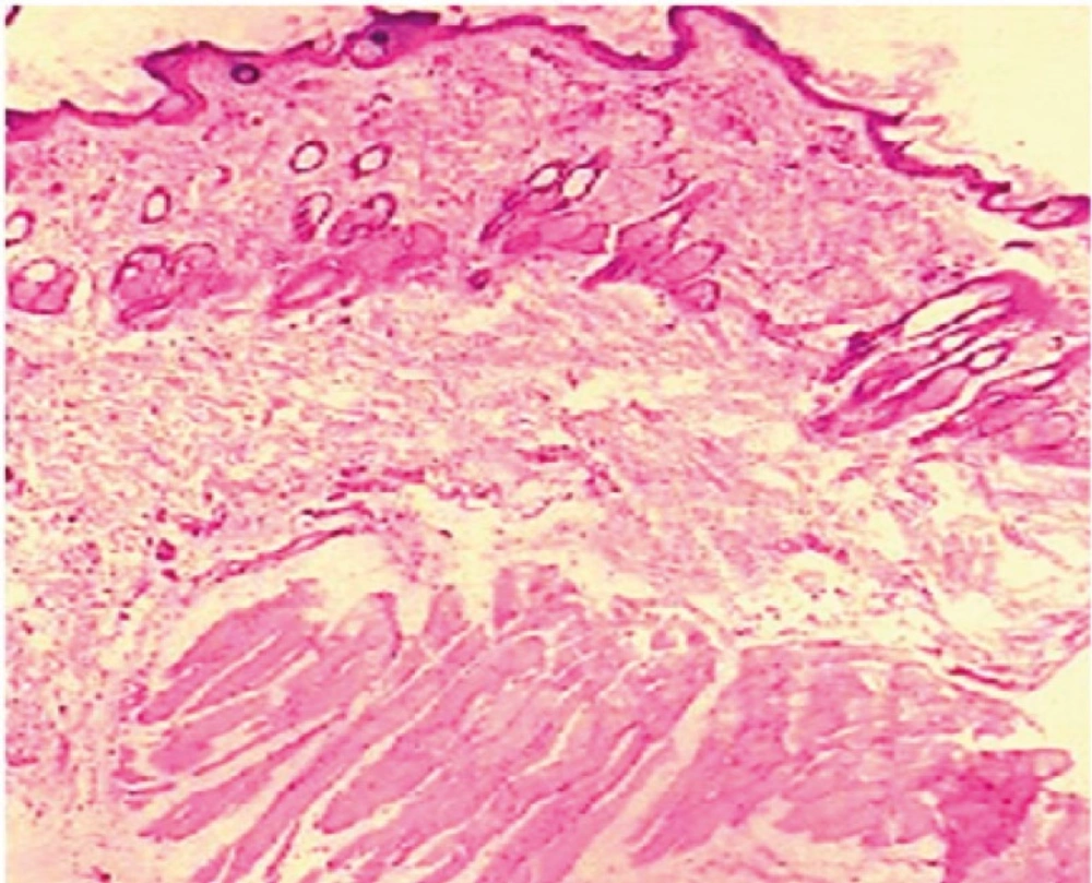Light power photomicrograph of control skin