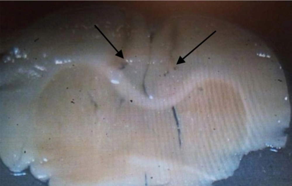 micrograph image of the injection site in the PL region