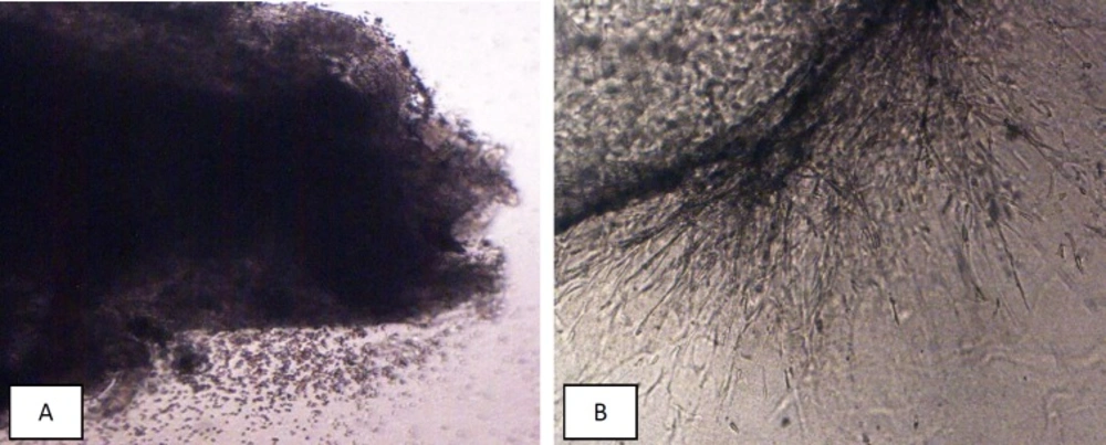 (A) Small endometrial fragment in fibrin jell at first day of 3D culture, there is no morphological changes. (B) Growth changes (endothlial cells sprothig) during 3rd week of 3D culture