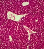 Calcium Dobesilate Ameliorates Cisplatin-induced Hepatotoxicity by Inhibiting Liver Oxidative Stress in Mice