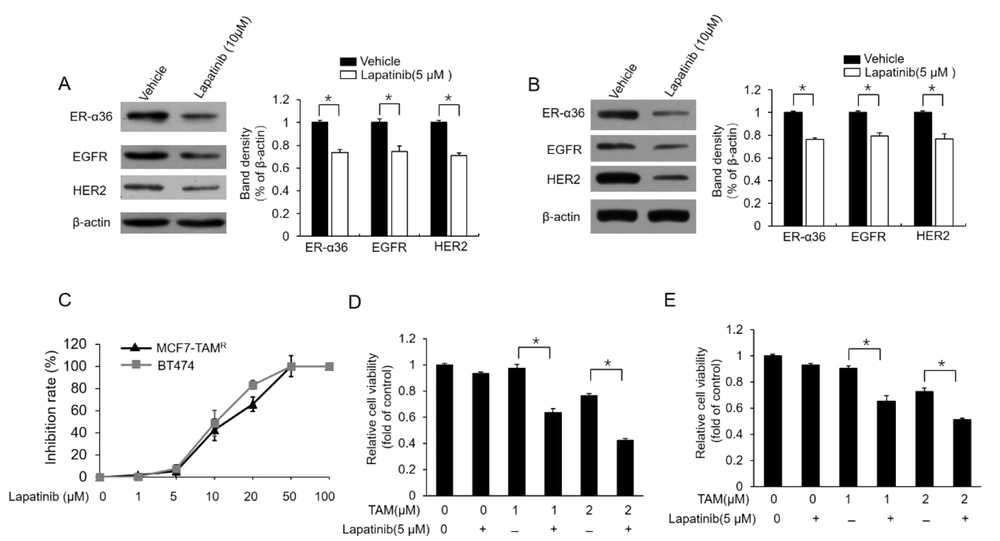 Downregulation of dual kinase inhibitor lapatinib estrogen receptor (ER)-α36 expression and sensitization of TAM-resistant cells to TAM; (A) and (B) western blot analysis of the expression of ER-a36, epidermal growth factor receptor (EGFR), and human epidermal growth factor receptor 2 (HER2) in MCF7-TAM<sup>R</sup> (A) and BT-474 (B) cells treated with 5 μM lapatinib for 48 hours; (C) inhibitory effects of different doses of lapatinib on the viability of MCF7-TAM<sup>R</sup> and BT-474 cells; (D) and (E) MCF7-TAM<sup>R</sup> (D) and BT-474 (E) cells treated with the indicated concentrations of TAM (2 μM) with a vehicle or 5 μM lapatinib for 7 days. The numbers of surviving cells were counted. The columns and bars represent the means of three experiments and the standard error of the mean, respectively (*P < 0.05). Downregulation of dual kinase inhibitor lapatinib estrogen receptor (ER)-α36 expression and sensitization of TAM-resistant cells to TAM; (A) and (B) western blot analysis of the expression of ER-a36, epidermal growth factor receptor (EGFR), and human epidermal growth factor receptor 2 (HER2) in MCF7-TAM<sup>R</sup> (A) and BT-474 (B) cells treated with 5 μM lapatinib for 48 hours; (C) inhibitory effects of different doses of lapatinib on the viability of MCF7-TAM<sup>R</sup> and BT-474 cells; (D) and (E) MCF7-TAM<sup>R</sup> (D) and BT-474 (E) cells treated with the indicated concentrations of TAM (2 μM) with a vehicle or 5 μM lapatinib for 7 days. The numbers of surviving cells were counted. The columns and bars represent the means of three experiments and the standard error of the mean, respectively (*P < 0.05).