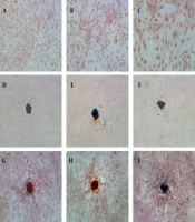 Cover image of the article: Icariin Exerts Estrogen-Like Actions on Proliferation of Osteoblasts in Vitro via Membrane Estrogen Receptors-Mediated Non-nuclear Effects