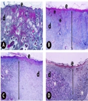 A Lead Target Molecule for Excisional Wound Healing: Trypthantrin Compound
