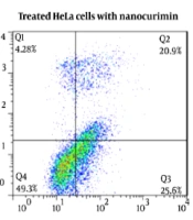 Cover image of the article: Investigation of Curcumin-Loaded OA400 Nanoparticle’s Effect on the Expression of E6 and E7 Human Papilloma-Virus Oncogenes and P53 and Rb Factors in HeLa Cell Line