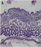 Cover image of the article: Mouse Model of Irritant Contact Dermatitis
