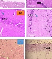 Cover image of the article: Downregulation of Bax/Bcl-2 Expression During Apoptosis in the Hippocampus of Diabetic Male Wistar Rats: Ameliorative Effects of Peganum harmala Seed Extract