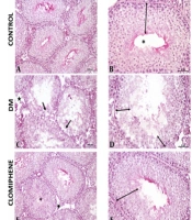 Effects of Vincamine on Testicular Dysfunction in Alloxan-induced Diabetic Male Rats