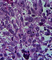 Tumor Suppression by PD-1/PD-L1 Interaction Blockage in Mice Model