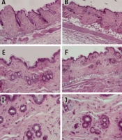 Stauntonia hexaphylla Extract Ameliorates Androgenic Alopecia by Inhibiting Androgen Signaling in Testosterone-induced Alopecia Mice