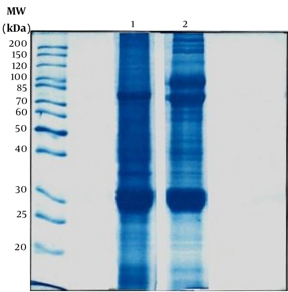 One-dimensional electrophoresis sodium dodecyl sulfate-polyacrylamide gel electrophoresis (SDS-PAGE). Column 1 is related to mature silkworm extract, and column 2 is related to silk pupae extract. The molecular weights of the proteins of the extracts appeared in the range of 20 - 200 kDa. One-dimensional electrophoresis sodium dodecyl sulfate-polyacrylamide gel electrophoresis (SDS-PAGE). Column 1 is related to mature silkworm extract, and column 2 is related to silk pupae extract. The molecular weights of the proteins of the extracts appeared in the range of 20 - 200 kDa.