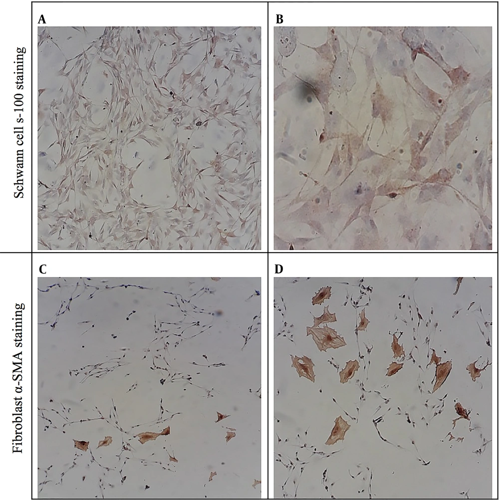 Schwann cells (A, B) and fibroblast (C, D) were immunocytochemically stained against S-100 and alpha-smooth muscle actin (α-SMA), respectively. As can be seen in A and B images, the abundance of Schwann cells is noticeable, but in C and D images, the number of fibroblasts is very low. Schwann cells (A, B) and fibroblast (C, D) were immunocytochemically stained against S-100 and alpha-smooth muscle actin (α-SMA), respectively. As can be seen in A and B images, the abundance of Schwann cells is noticeable, but in C and D images, the number of fibroblasts is very low.