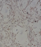 Evaluation and Comparison of the Effects of Mature Silkworm (Bombyx mori) and Silkworm Pupae Extracts on Schwann Cell Proliferation and Axon Growth: An In Vitro Study