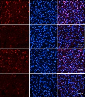 Spermidine Alleviates Intrauterine Hypoxia-Induced Offspring Newborn Myocardial Mitochondrial Damage in Rats by Inhibiting Oxidative Stress and Regulating Mitochondrial Quality Control