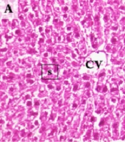 CREB1 and PPAR-α/γ Pathways in Hepatic Ischemia/Reperfusion: Route for Curcumin to Hepatoprotection