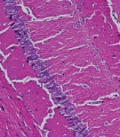Cover image of the article: Amelioratory Effect of Melatonin on Cognition Dysfunction Induced by Sevoflurane Anesthesia in Aged Mice