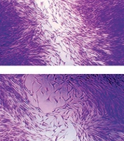 Evaluation of Antioxidant and Antibacterial Effects of Lyophilized Cell-Free Probiotic Supernatants of Three Lactobacillus spp. and Their Cytocompatibility Against Periodontal Ligament Stem Cells
