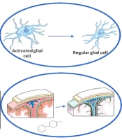 Cover image of the article: Efficacy of Probiotics in Improving Motor Function and Alleviating Constipation in Parkinson’s Disease: A Randomized Controlled Trial