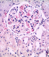 Effect of Solanum melongena on Components and Kidney Damage of Fructose-Induced Metabolic Syndrome in Rats