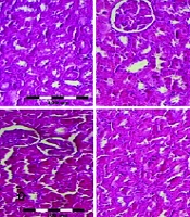 The Effects of ThymusCaramanicus Jalas Extract and Its Main Constituent Carvacrol Against Cisplatin-Induced Nephrotoxicity in Mice
