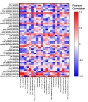 Glucose Metabolism in Acute Myeloid Leukemia Cell Line Is Regulated via Combinational PI3K/AKT/mTOR Pathway Inhibitors