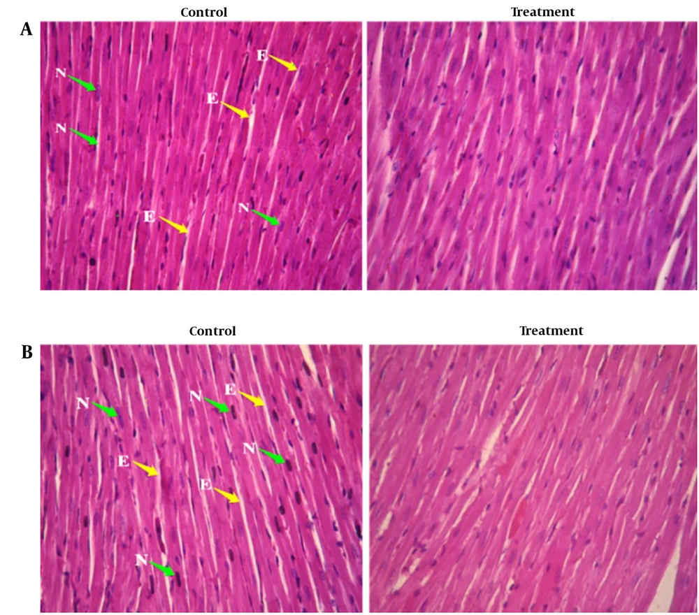 Photomicrograph of the sectioned heart of A, female rats: Control and treated with 1 000 mg/kg Camelina oil; B, male rats: Control and treated with 1 000 mg/kg Camelina oil N: Nuclear, E: Endomysium. Photomicrograph of the sectioned heart of A, female rats: Control and treated with 1 000 mg/kg Camelina oil; B, male rats: Control and treated with 1 000 mg/kg Camelina oil N: Nuclear, E: Endomysium.