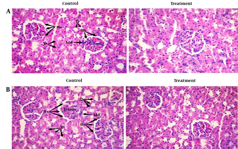 Photomicrograph of sectioned kidney of A, female rats: Control and treated with 1 000 mg/kg Camelina oil; B, male rats: Control and treated with 1 000 mg/kg Camelina oil. Bs: Bowman, Md: Macula densa, D: Distal. Photomicrograph of sectioned kidney of A, female rats: Control and treated with 1 000 mg/kg Camelina oil; B, male rats: Control and treated with 1 000 mg/kg Camelina oil. Bs: Bowman, Md: Macula densa, D: Distal.