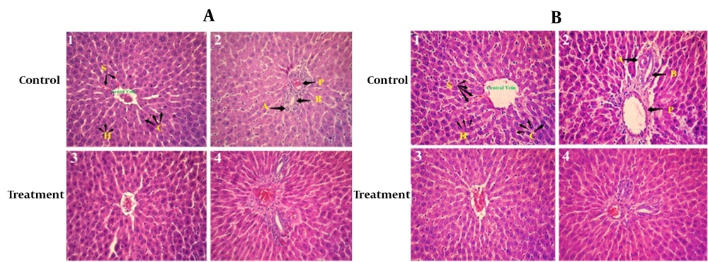 Photomicrograph of sectioned liver of A, female rats: Control and treated with 1 000 mg/kg Camelina oil; B, male rats: Control and treated with 1 000 mg/kg Camelina oil. A: Artery, P: Portal vein, B: Bile duct, H: Hepatocyte. Photomicrograph of sectioned liver of A, female rats: Control and treated with 1 000 mg/kg Camelina oil; B, male rats: Control and treated with 1 000 mg/kg Camelina oil. A: Artery, P: Portal vein, B: Bile duct, H: Hepatocyte.