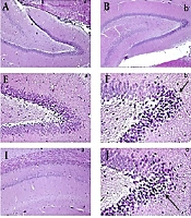 The Protective Effects of Pistacia Atlantica Gum in a Rat Model of Aluminum Chloride-Induced Alzheimer’s Disease via Affecting BDNF and NF-kB